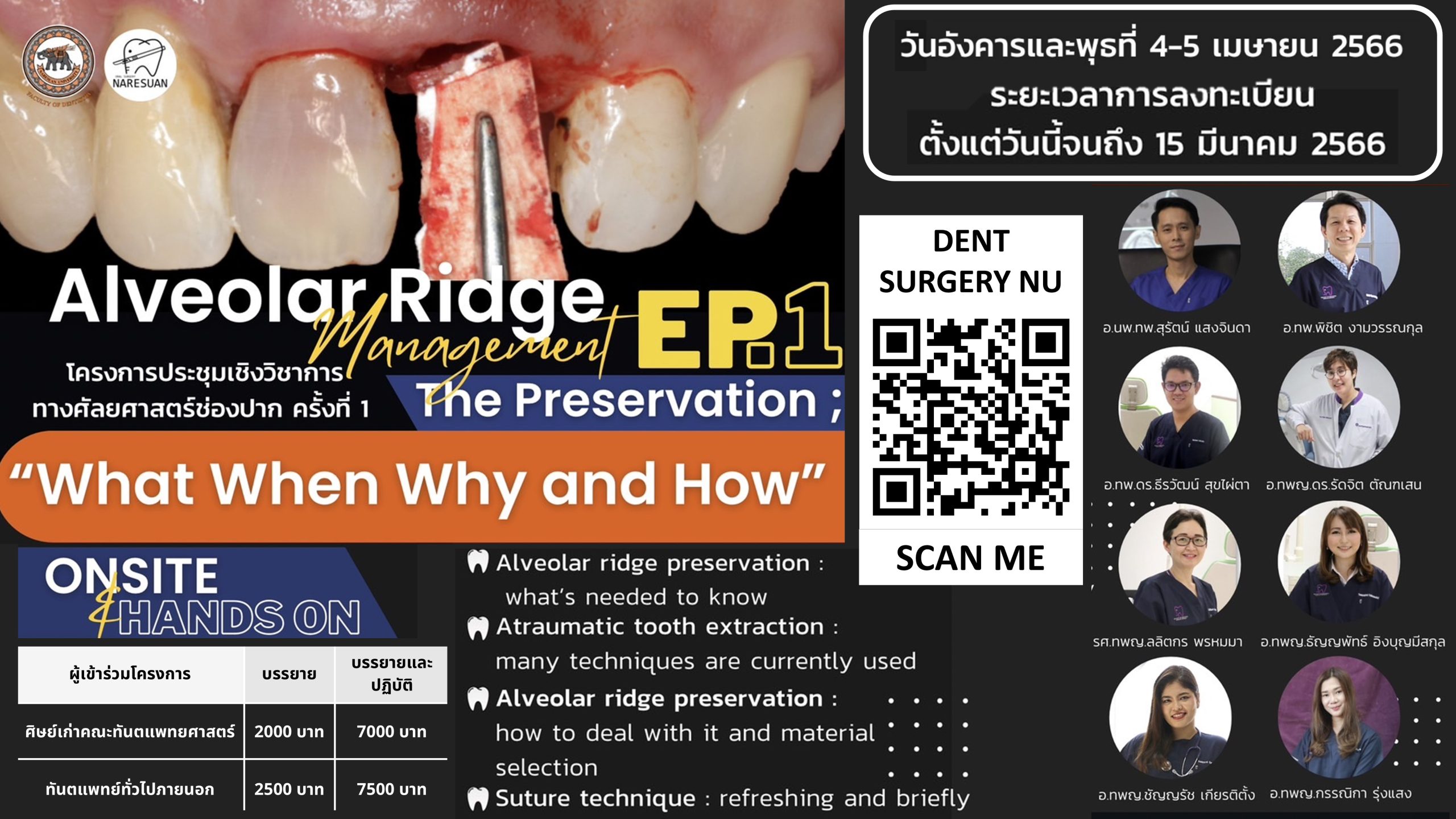 En-โครงการประชุมเชิงวิชาการทางศัลยศาสตร์ช่องปาก ครั้งที่ 1 เรื่อง “Alveolar Ridge Management: Ep.1 The Preservation; What When Why and How”