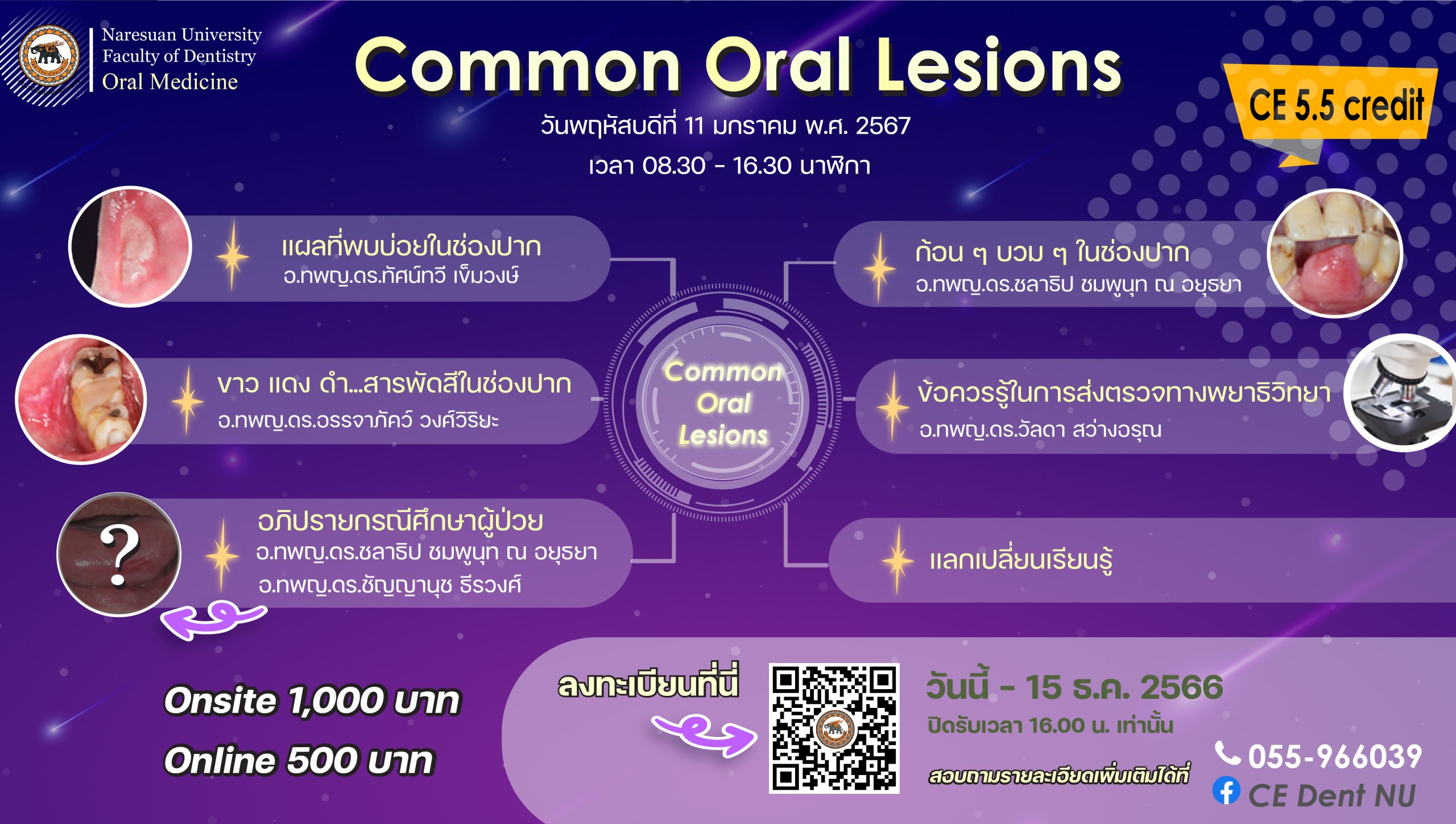 โครงการประชุมเชิงวิชาการ เรื่อง “Common Oral Lesions” (สมัครได้ถึง 15 ธ.ค. 66 เวลา 16:00 น.)